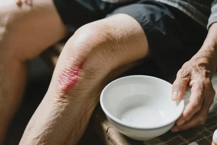 高齡老人大腿經(jīng)常長(zhǎng)濕疹能夠徹底治愈嗎(圖3)