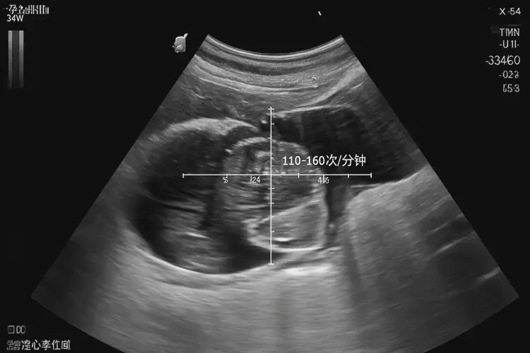 孕34周5天胎心100正常嗎(圖4)