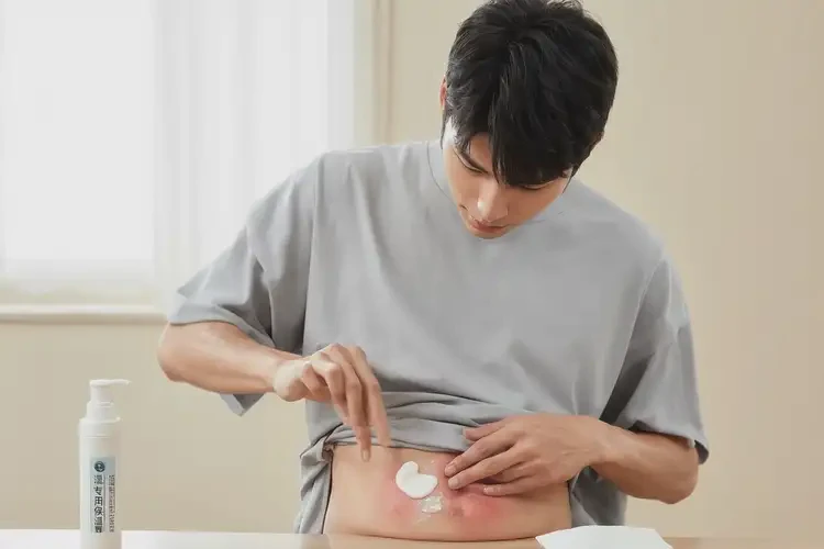 青年人肚子長濕疹可不可以徹底自愈(圖2)