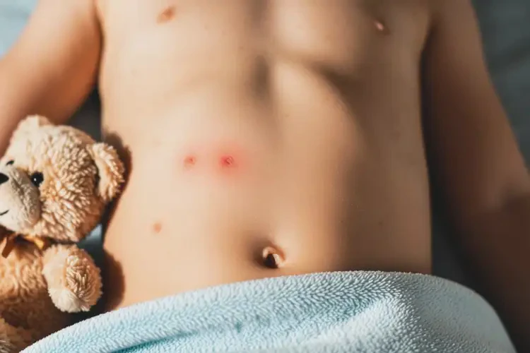 兒童肚子上出濕疹可不可以徹底自愈(圖4)