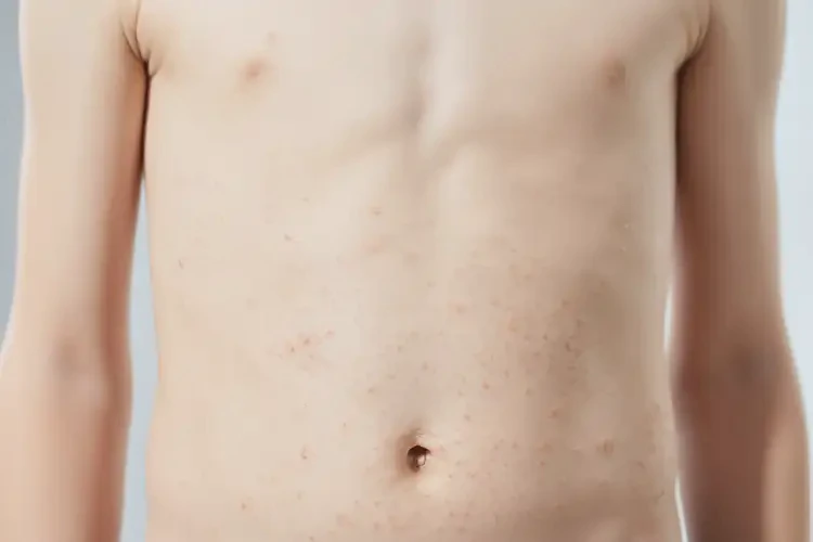 青少年肚子上起濕疹能夠徹底治愈嗎(圖4)