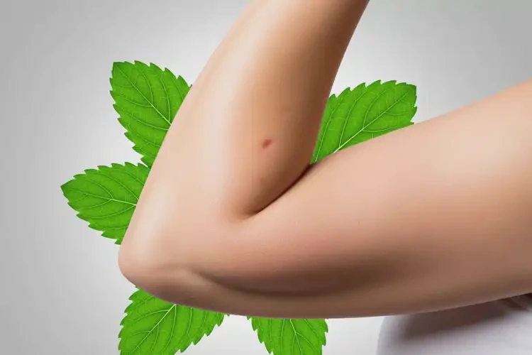 產(chǎn)婦手臂經(jīng)常起濕疹能靠自己自愈嗎(圖3)