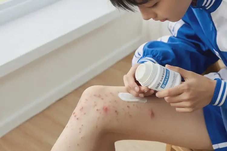 中学生小腿上容易长湿疹能够彻底治愈吗(图2)