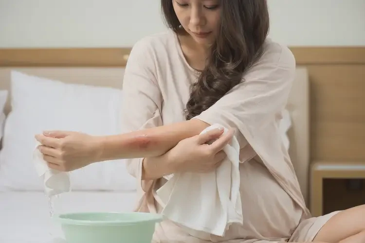 產(chǎn)婦手臂上容易長(zhǎng)濕疹可不可以徹底自愈(圖3)