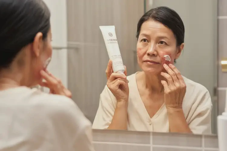 女性面部有濕疹能靠自己自愈嗎(圖2)