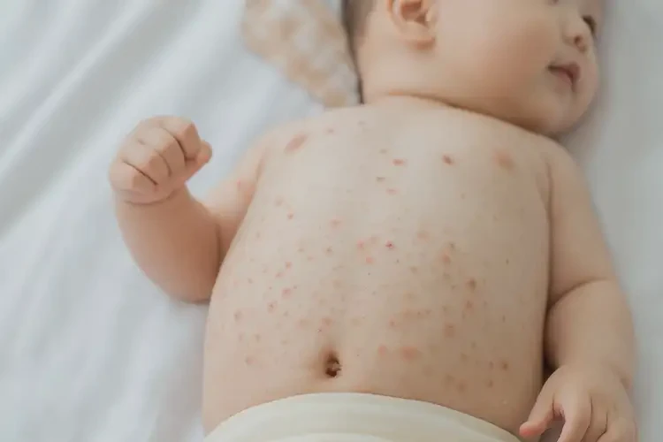 寶寶肚子出現(xiàn)濕疹能靠自己自愈嗎(圖4)