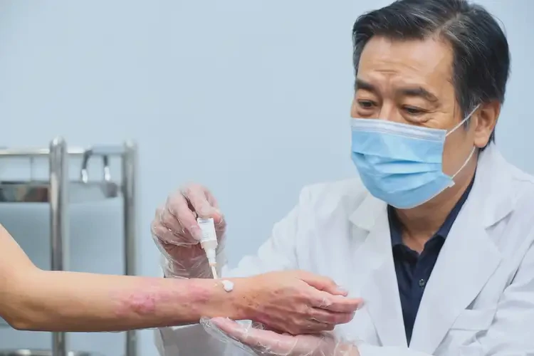 男人手上出現(xiàn)濕疹可不可以徹底自愈(圖3)