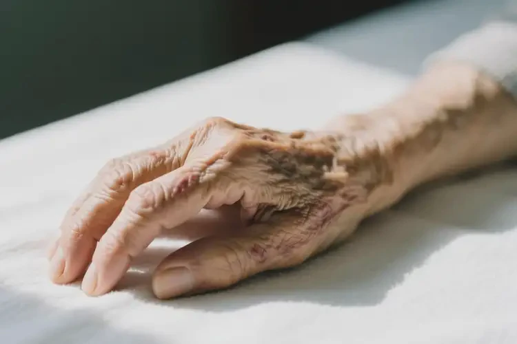 高齡老人手臂出濕疹可以徹底自愈嗎(圖3)