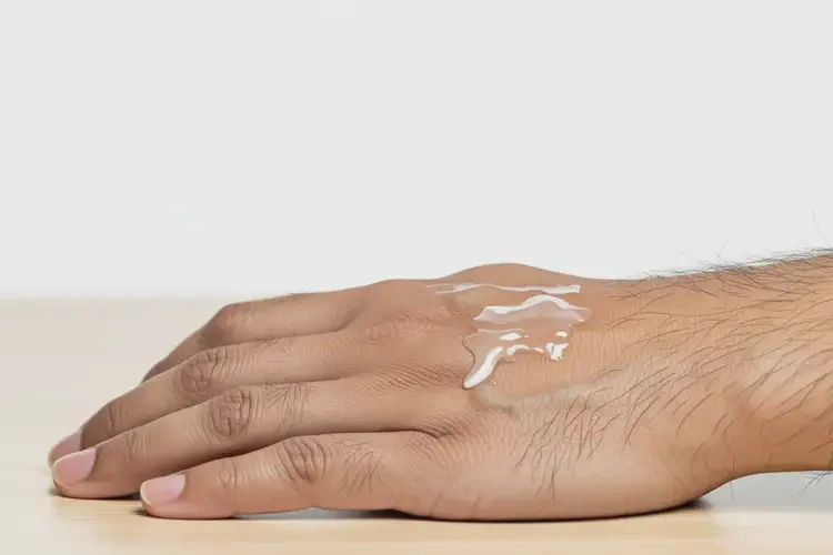 男性手上偶爾起濕疹可不可以徹底自愈(圖2)