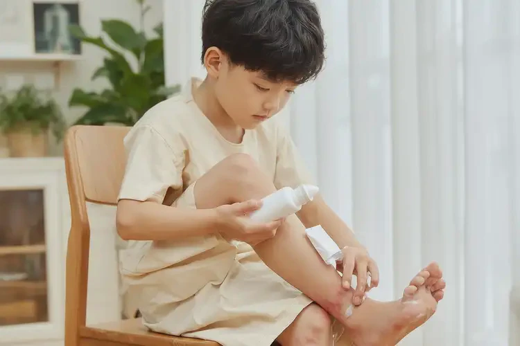 孩子腳上起濕疹可以徹底自愈嗎(圖2)