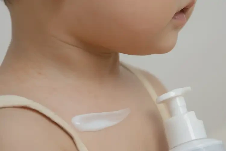 幼兒脖子出濕疹能徹底自愈嗎(圖3)