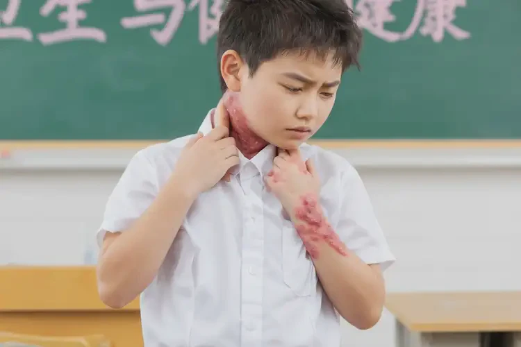 小學生脖子上容易長濕疹不管它會自己自愈嗎(圖4)