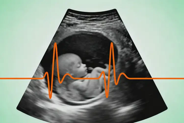 中期妊娠胎心88有危險嗎(圖4)