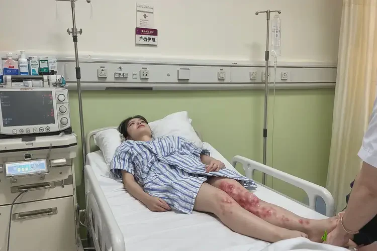 產(chǎn)婦大腿偶爾起濕疹不管它會(huì)自己自愈嗎(圖3)