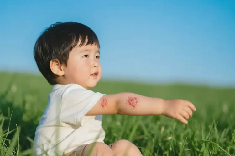 小兒手臂上經(jīng)常長濕疹能靠自己自愈嗎(圖3)