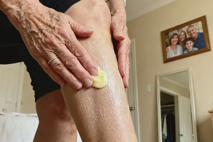 老年人小腿上偶爾長濕疹可以徹底自愈嗎(圖1)