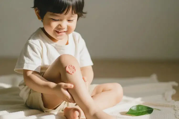 孩子大腿出現(xiàn)濕疹不管它會自己自愈嗎(圖3)