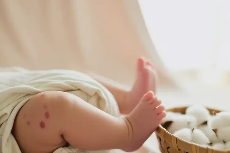 新生兒身上偶爾起濕疹能徹底自愈嗎(圖1)
