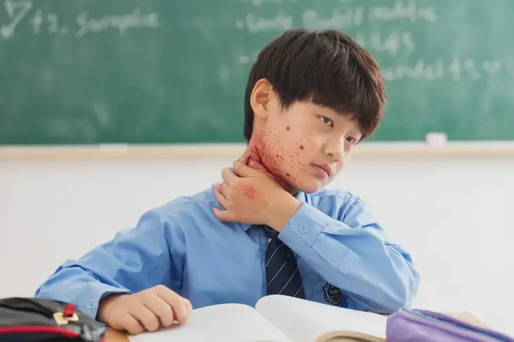 小學(xué)生脖子上容易長(zhǎng)濕疹能靠自己自愈嗎(圖4)