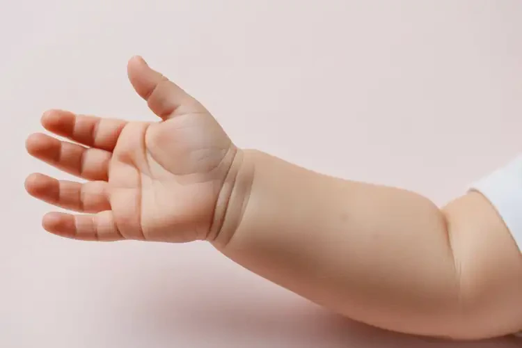 嬰兒手臂上偶爾起濕疹不管它會(huì)自己痊愈嗎(圖2)