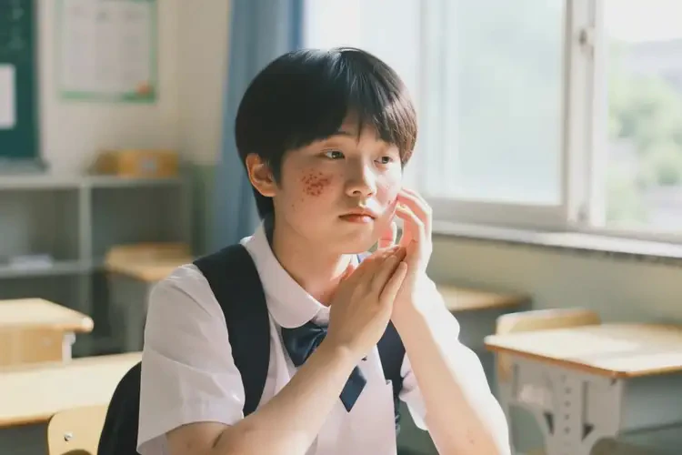 中學(xué)生面部經(jīng)常起濕疹能靠自己自愈嗎(圖4)