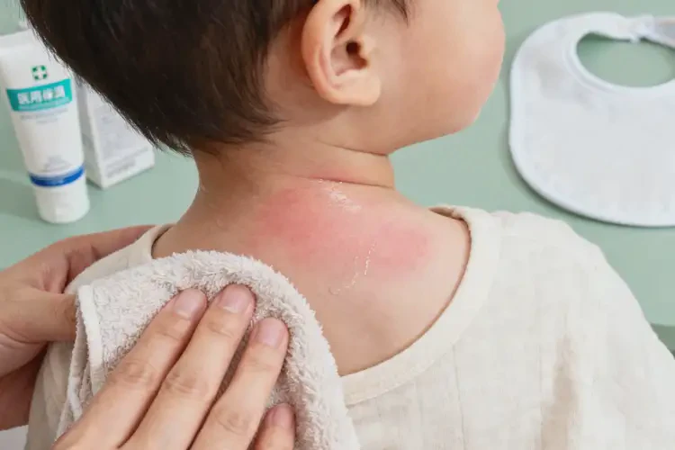 幼兒脖子上經常起濕疹不管它會自己痊愈嗎(圖2)