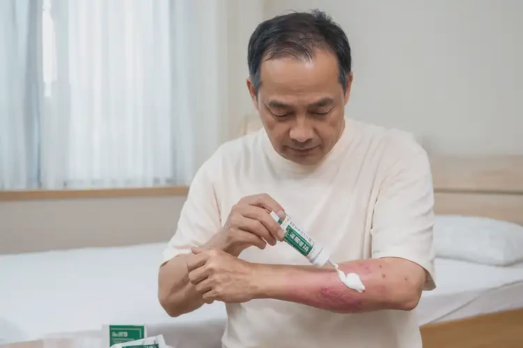 男性屁股偶尔长湿疹不管它会自己痊愈吗(图2)