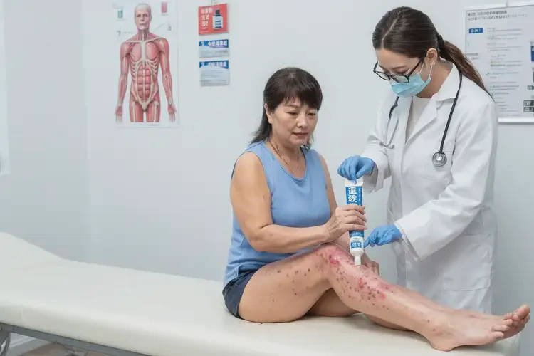 女生小腿上經常長濕疹能夠徹底治愈嗎(圖4)