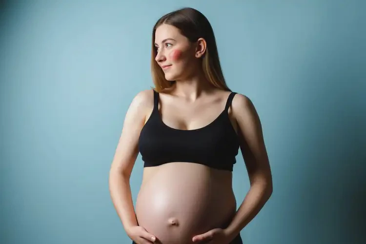 孕妇面部经常长湿疹可不可以彻底自愈(图1)