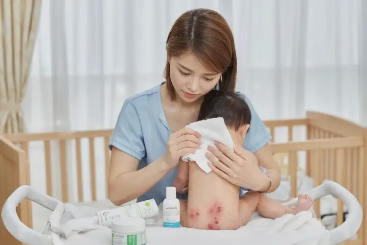 嬰兒屁股出現(xiàn)濕疹能徹底自愈嗎(圖3)