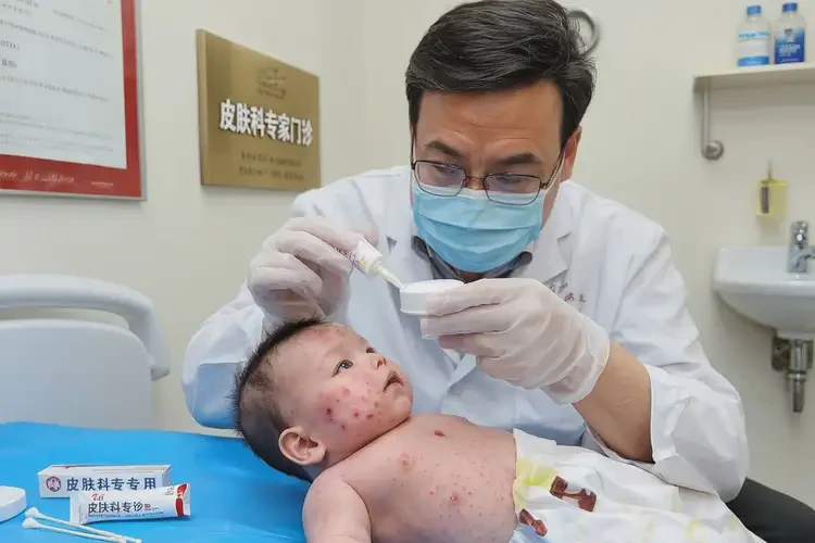 新生兒面部經(jīng)常起濕疹能靠自己自愈嗎(圖2)