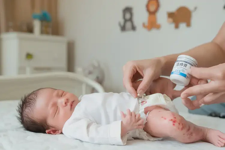 新生兒大腿出濕疹不管它會自己自愈嗎(圖3)