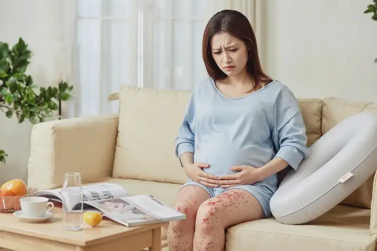 孕婦腳上有濕疹不管它會(huì)自己好嗎(圖4)