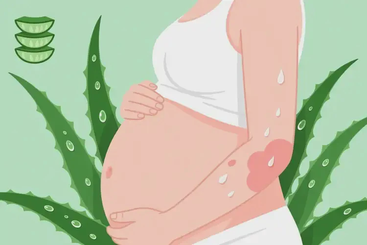 孕婦手臂上出濕疹可不可以徹底自愈(圖2)