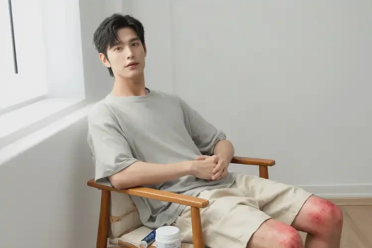 青年人小腿有濕疹不管它會自己好嗎(圖2)