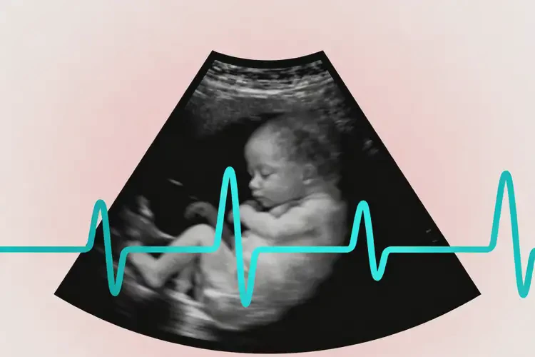 中期妊娠胎心88有危險嗎(圖2)