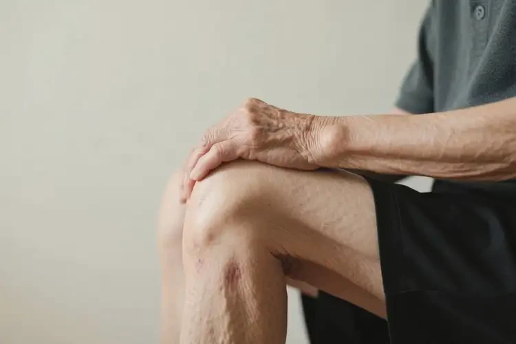 高齡老人大腿經(jīng)常長(zhǎng)濕疹能夠徹底治愈嗎(圖1)