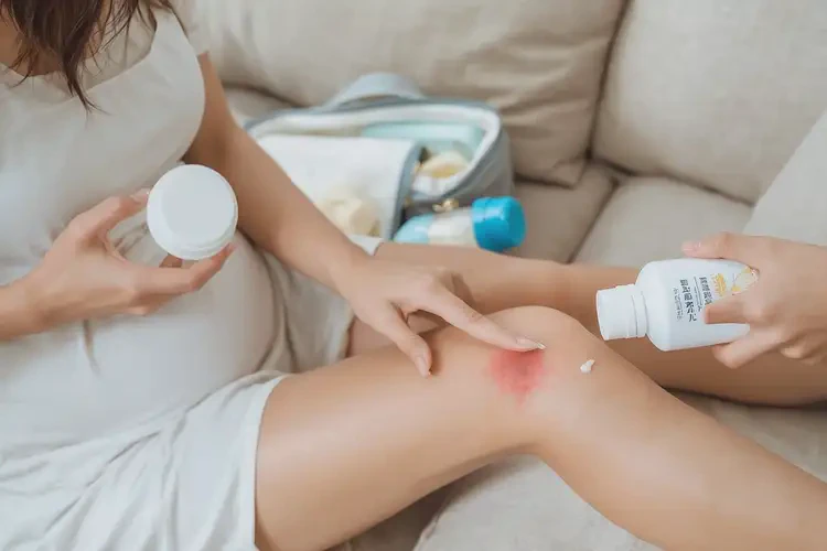 哺乳期媽媽小腿上起濕疹能徹底自愈嗎(圖4)