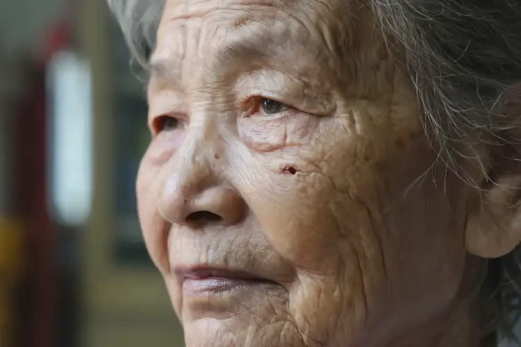 老人屁股起濕疹可以徹底自愈嗎(圖3)