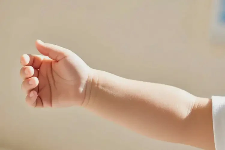 小孩手臂上容易起濕疹能靠自己自愈嗎(圖4)