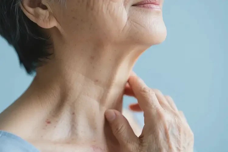 老年人脖子有湿疹可不可以彻底自愈(图3)