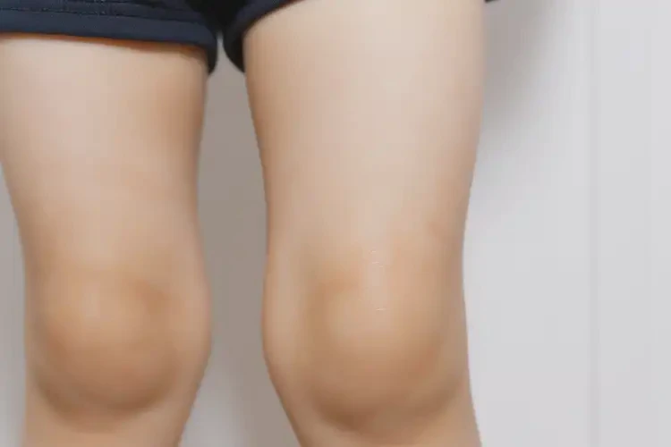 少兒小腿出現(xiàn)濕疹能夠徹底治愈嗎(圖4)