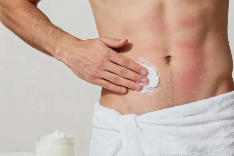 男性肚子上經(jīng)常起濕疹能徹底自愈嗎(圖1)