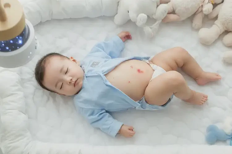 嬰兒肚子上偶爾長濕疹可以徹底自愈嗎(圖4)