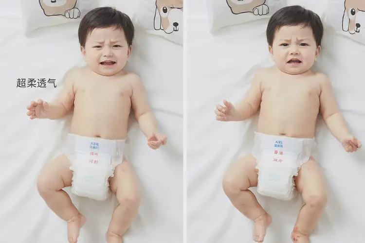 嬰兒屁股經(jīng)常起濕疹可不可以徹底自愈(圖2)