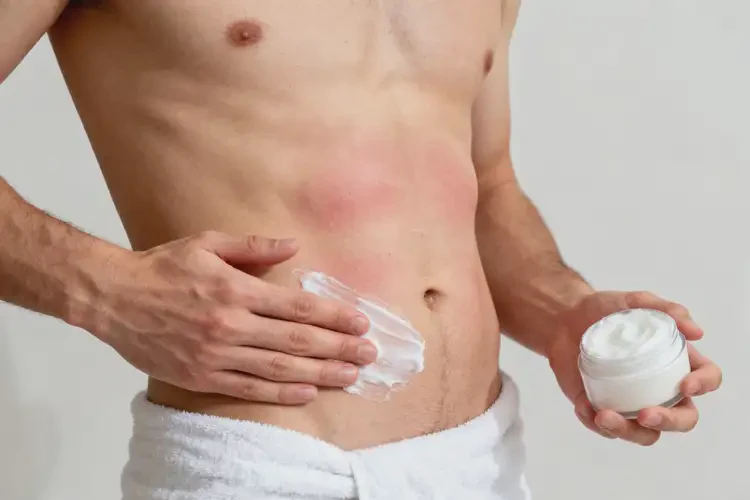 男性肚子上經(jīng)常起濕疹能徹底自愈嗎(圖4)