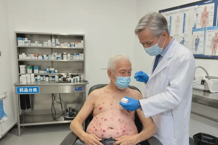 老年人肚子起濕疹不管它會(huì)自己自愈嗎(圖3)