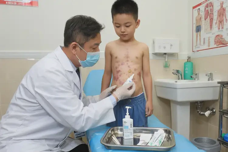 兒童肚子上容易起濕疹能徹底自愈嗎(圖3)