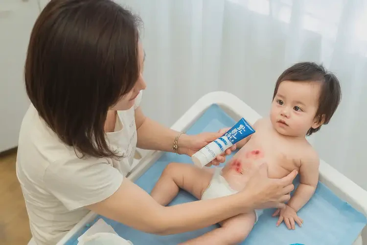 小孩肚子上出现湿疹可以彻底自愈吗(图2)