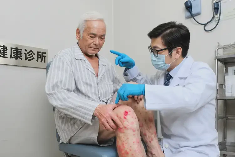 高齡老人小腿容易長濕疹不管它會自己好嗎(圖2)